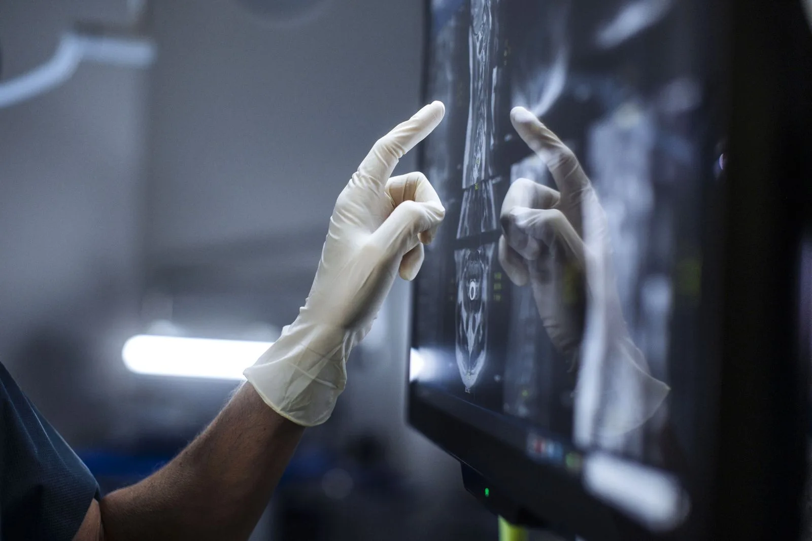 A.I., Radyoloji Alanını Nasıl Yeniden Şekillendirecek – Radyologları Değiştirmeden