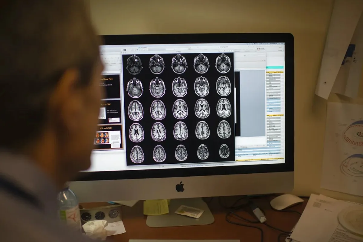 grid of MRI scans on a computer screen